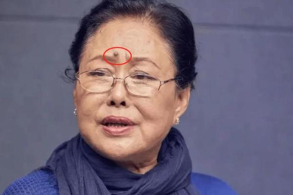 眉间长痣的奥秘：揭示命运与个性的深层含义