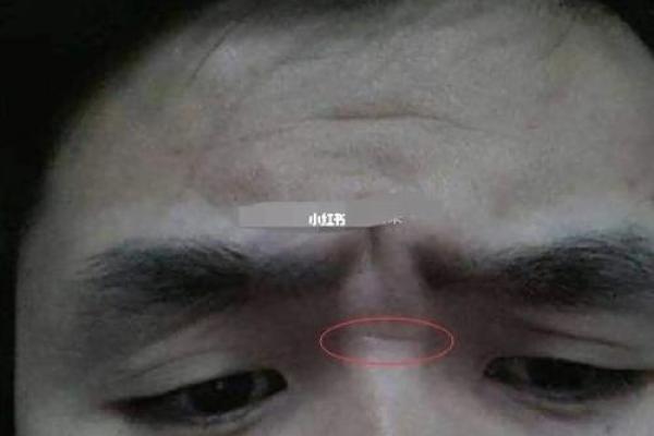 眉毛有刀疤是什么命？解密面相与命运的奥秘！