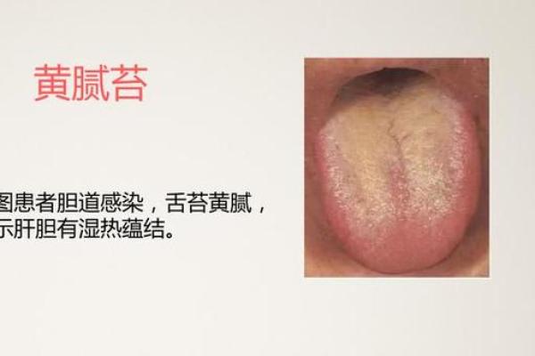 命里有积滞的含义与化解方法探讨